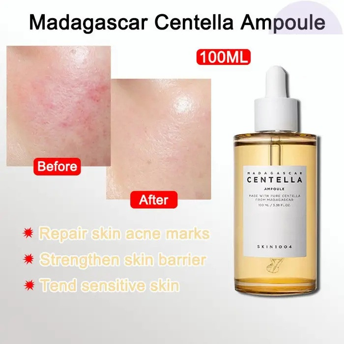 تونر سنتلا مدل Madagascar Centella Ampoule حجم 100 میلی‌لیتر