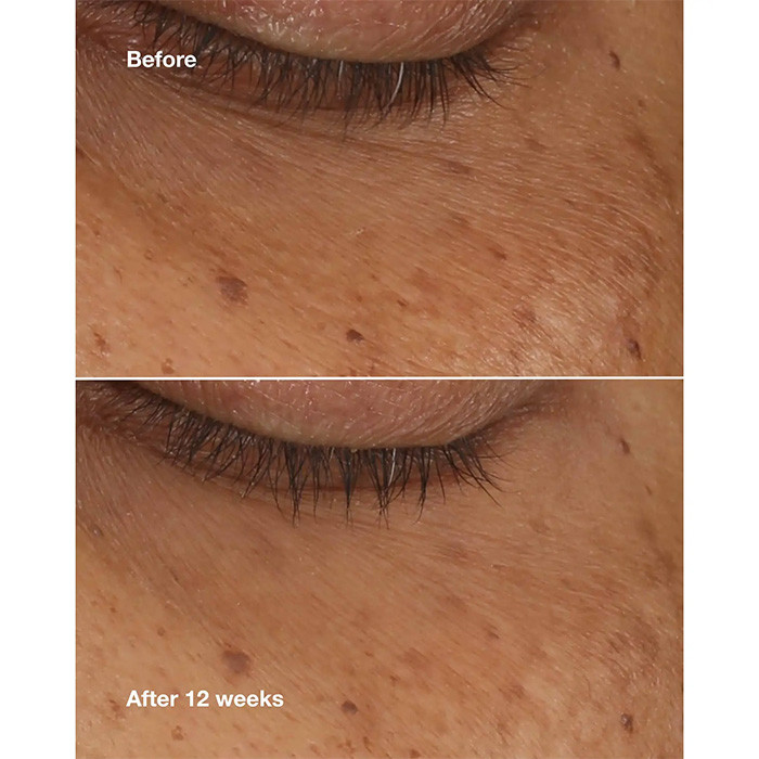 سرم ضد چروک و رفع تیرگی دور چشم کلینیک مدل All About Eyes مناسب انواع پوست حجم 10 میلی لیتر